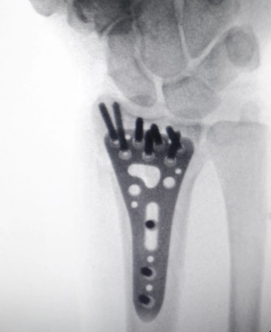 Hofer X-Ray
